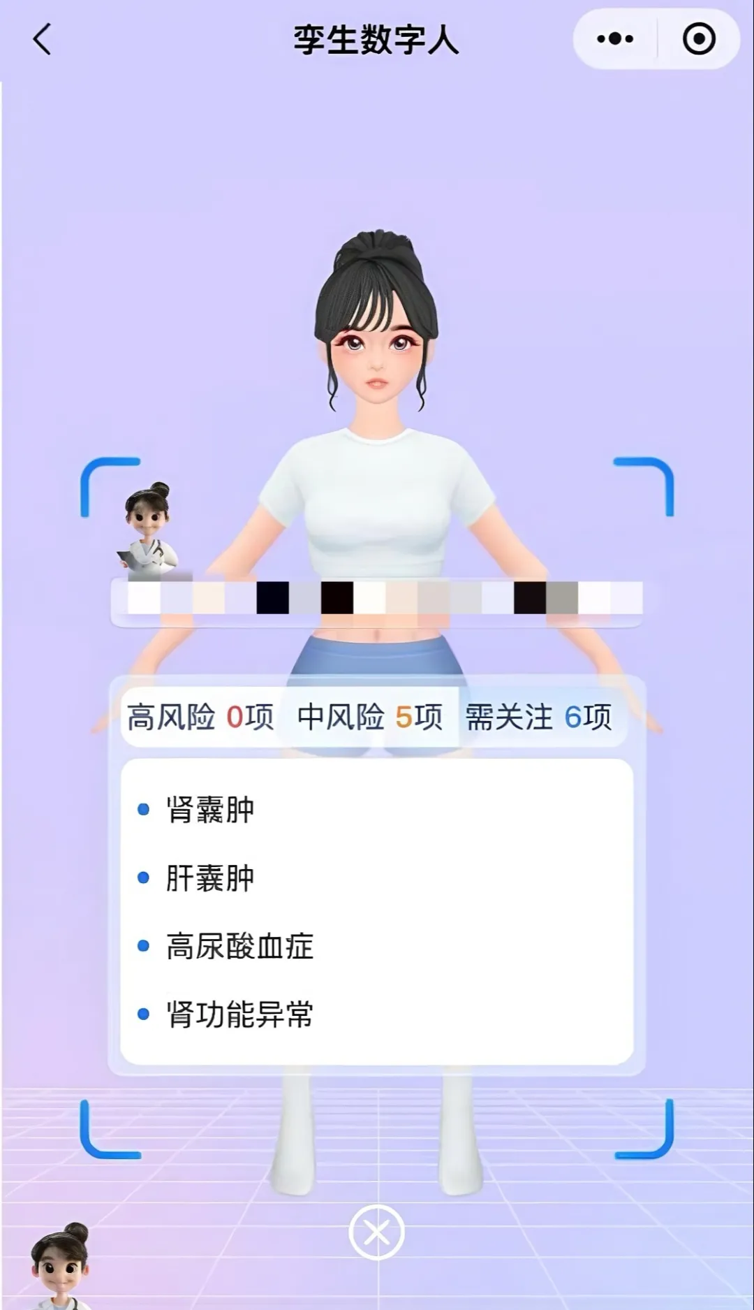 三六零：AI赋能难挽业绩颓势，三年半累亏超40亿，营收六连降缩水四成
