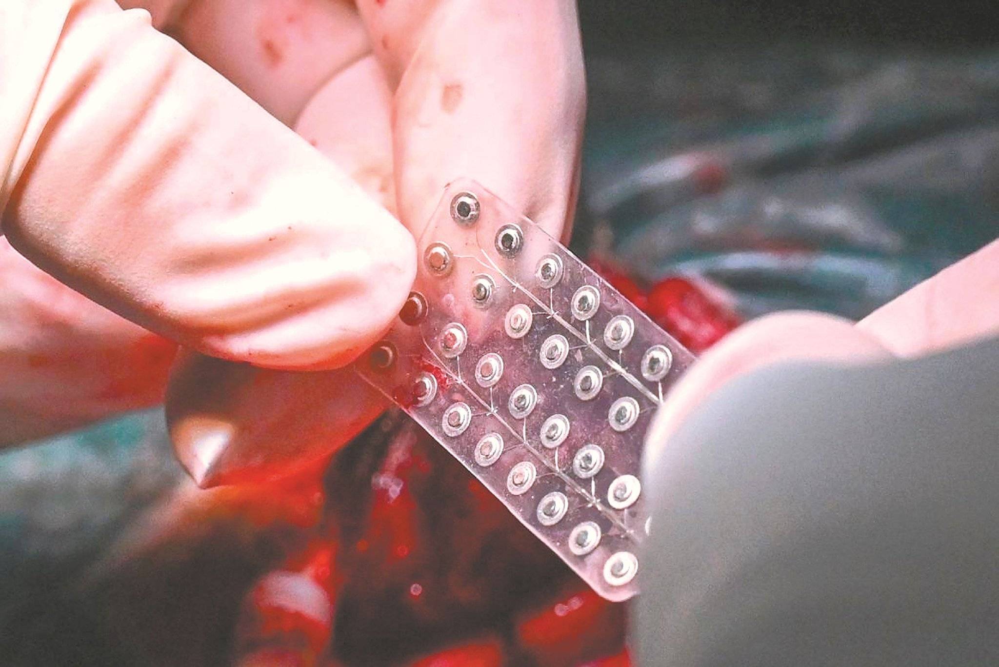 又一家脑机接口公司，备战IPO！红杉、百度加持